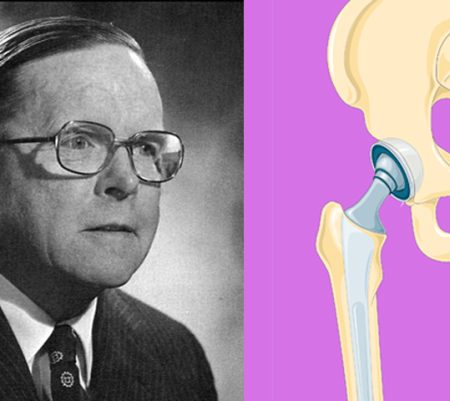 Hip Replacement Surgery